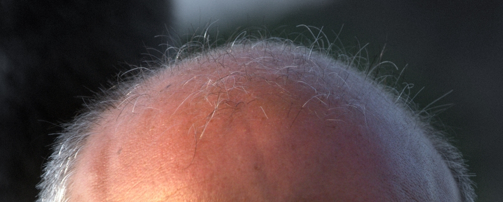 każdy włos jest policzony,zdjęcie: melehmann@flickr.com, CC-BY